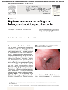 Papiloma escamoso del esófago - Revista de Gastroenterología de