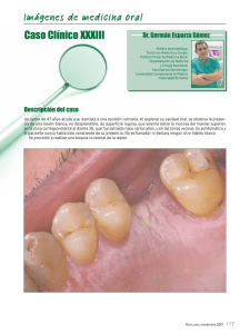 Caso Clínico XXXIII Imágenes de medicina oral