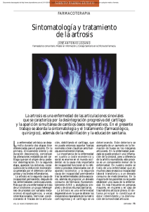 Sintomatología y tratamiento de la artrosis
