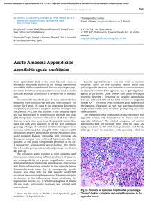 Acute Amoebic Appendicitis