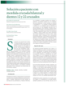 Solución a paciente con mordida cruzada bilateral y dientes 12 y 22