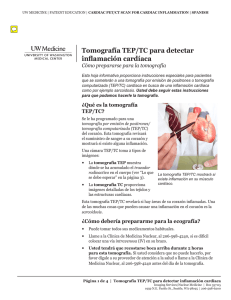 Tomografía TEP/TC para detectar inflamación cardíaca