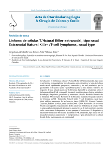 Linfoma de células T/Natural Killer extranodal, tipo nasal