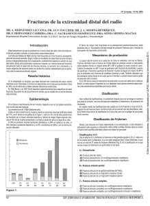 Fracturas de la extremidad distal del radio