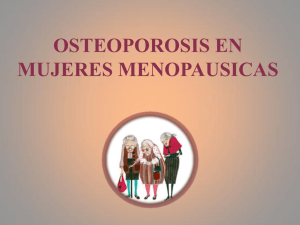 OSTEOPOROSIS EN MUJERES MENOPAUSICAS