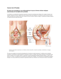 Cancer de la Prostata