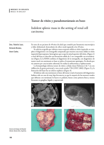 Tumor de riñón y pseudometástasis en bazo Indolent splenic mass