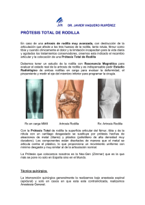 Prótesis Total de Rodilla