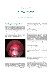 endometriosis - univadis.net