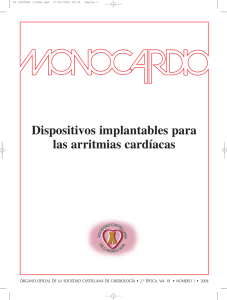 Dispositivos implantables para las arritmias cardíacas