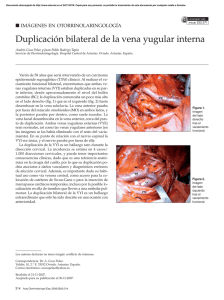 Duplicación bilateral de la vena yugular interna