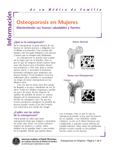 Osteoporosis en Mujeres: Manteniendo sus huesos saludables y