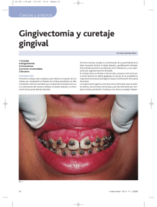 Gingivectomía y curetaje gingival