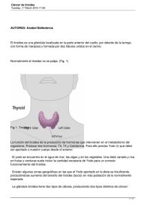 Cáncer de tiroides