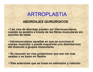 artroplastia 2