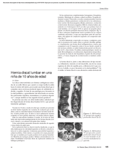 Hernia discal lumbar en una niña de 10 años de edad