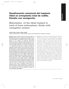 Desalineación rotacional del implante tibial en artroplastia