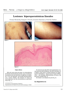 Lesiones hiperqueratósicas lineales