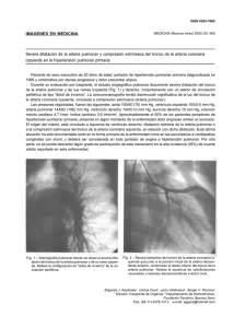 IMAGENES EN MEDICINA Severa dilatación de la arteria pulmonar
