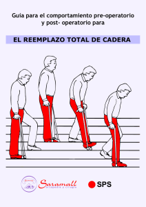 Guía para el comportamiento de reemplazo total de cadera