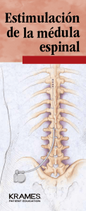 Estimulación de la médula espinal