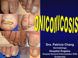 Onicomicosis - PIEL