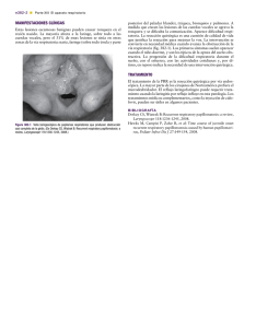 Neoplasias de laringe, tráquea y bronquios