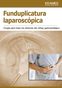 Funduplicatura laparoscópica