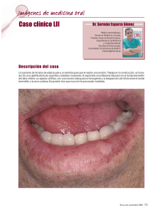 Caso clínico LII Imágenes de medicina oral