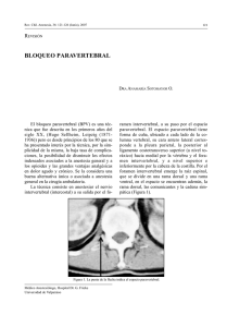 Bloque Paravertebral - Sociedad de Anestesiología de Chile