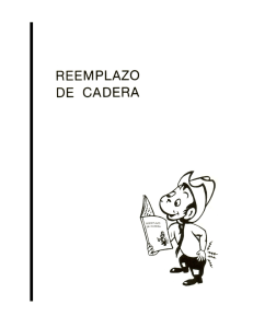 REEMPLAZO DE CADERA