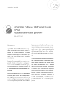 2 Enfermedad Pulmonar Obstructiva Crónica (EPOC). Aspectos