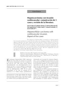 Hepatocarcinoma con invasión cardiovascular: comunicación de 5