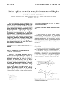 Hallux rigidus: resección artroplástica metatarsofalángica