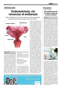 Endometriosis, sin renunciar al embarazo - Bio-Cord