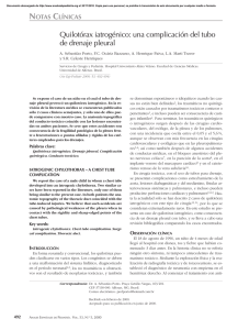 Quilotórax iatrogénico: una complicación del tubo de drenaje pleural