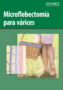 Microflebectomía para várices