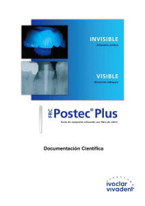 FRC Postec Plus - Ivoclar Vivadent