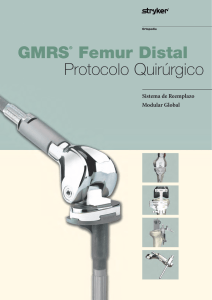 GMRS® Femur Distal Protocolo Quirúrgico