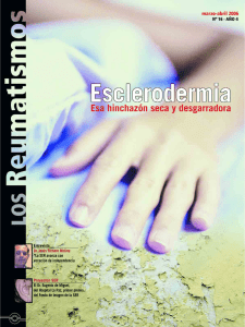 Esclerodermia. Esa hinchazón seca y desgarradora