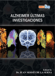 Alzheimer, Últimas Investigaciones - e