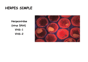 HERPES SIMPLE