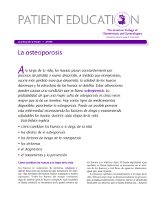 Patient Education Pamphlet, SP048, La osteoporosis