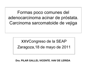 adenocarcinoma sarcomatoide de la próstata