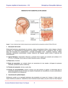 meningitis por haemophilus influenzae