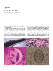 TOXOCARIASIS