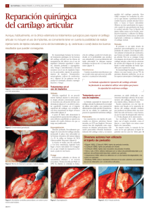 Reparación Quirúrgica del Cartílago Articular ("Pdf"