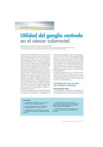 Utilidad del ganglio centinela en el cáncer colorrectal