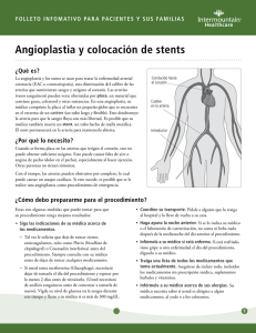 Angioplastia y colocación de stents