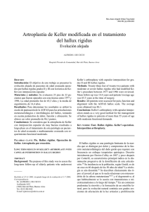 Artroplastia de Keller modificada en el tratamiento del hallux rigidus